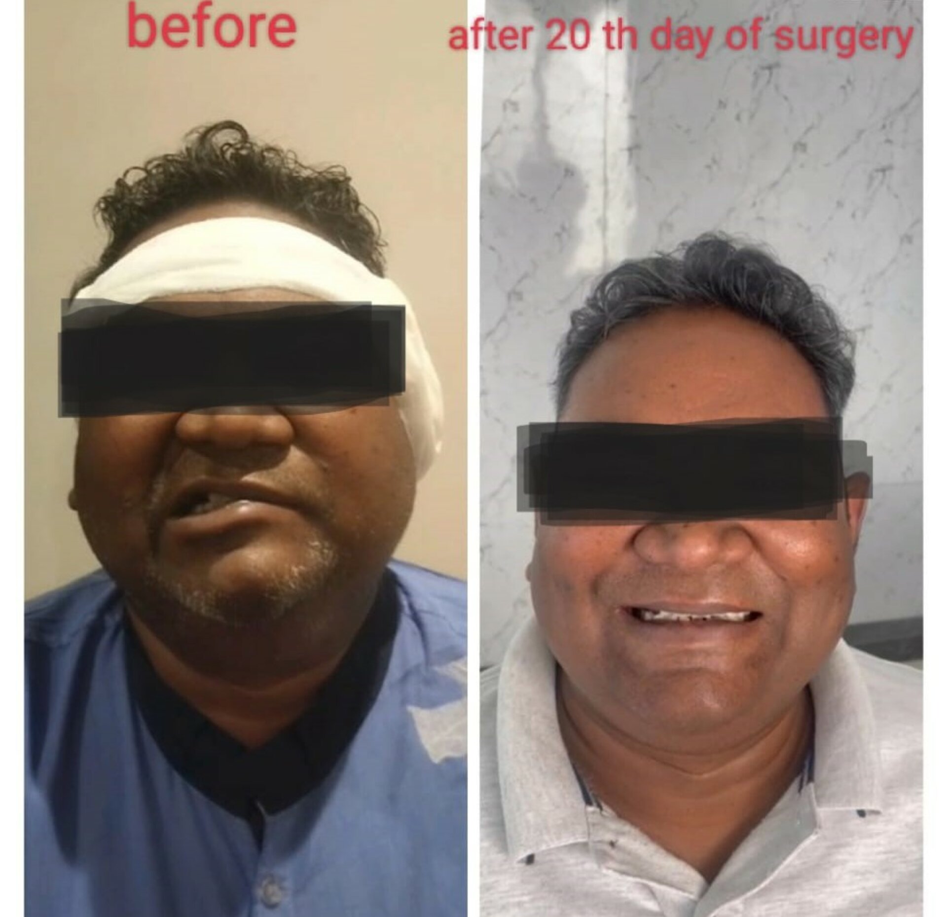 Dr Bhagat's ENT endoscopy clinic|Hadapsar,Pune