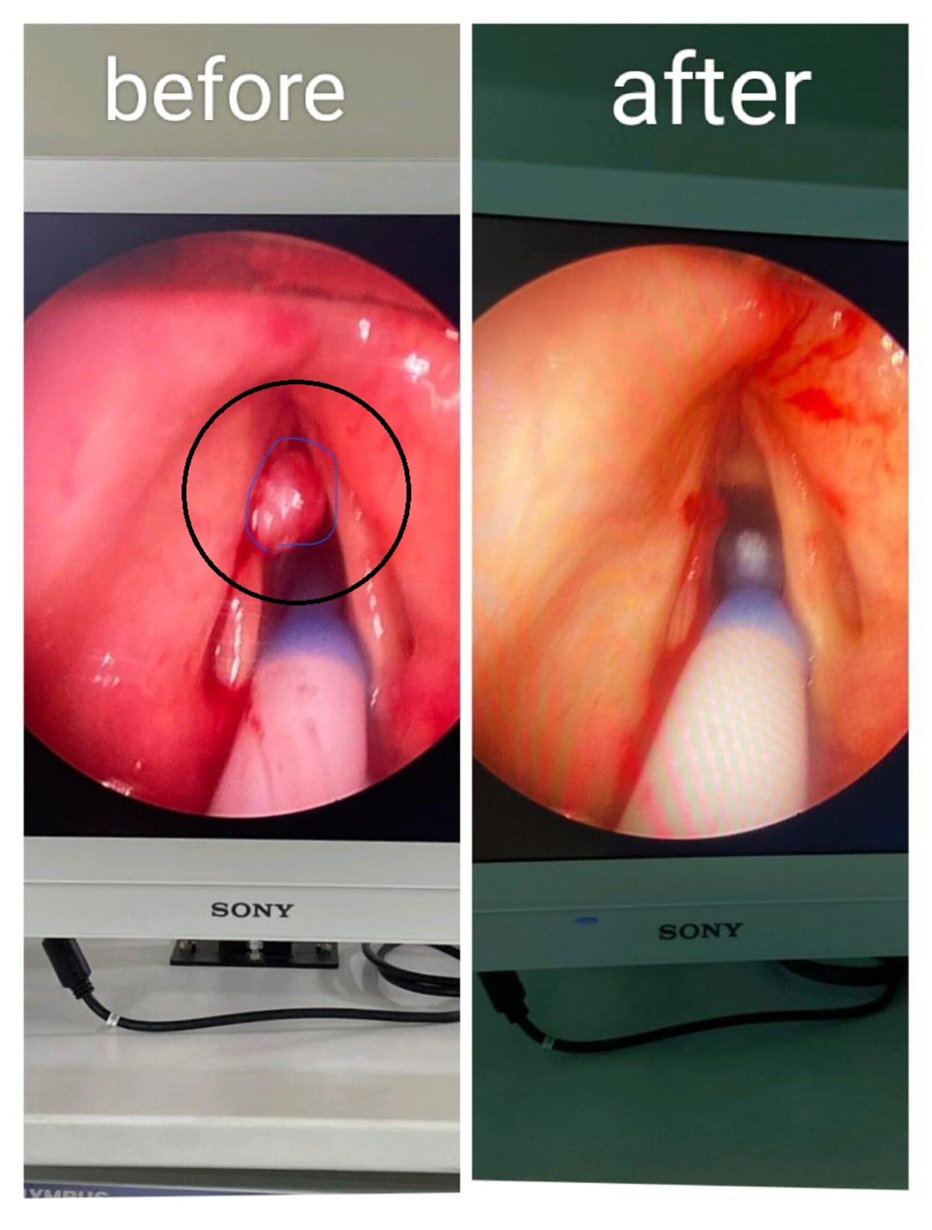 Dr Bhagat's ENT endoscopy clinic|Hadapsar,Pune